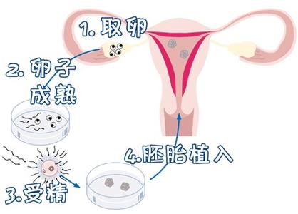 关于 私人高龄代怀助孕服务哪家好